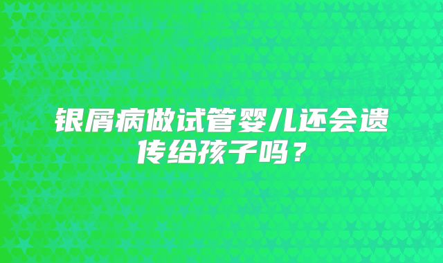 银屑病做试管婴儿还会遗传给孩子吗？