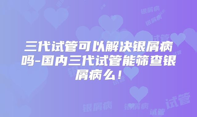 三代试管可以解决银屑病吗-国内三代试管能筛查银屑病么!