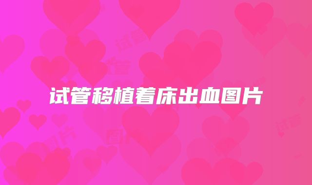 试管移植着床出血图片