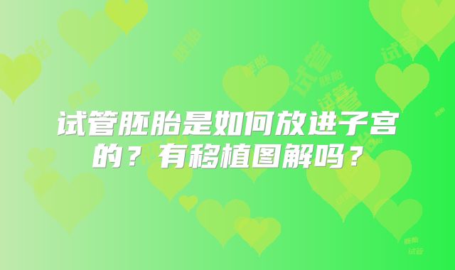 试管胚胎是如何放进子宫的？有移植图解吗？