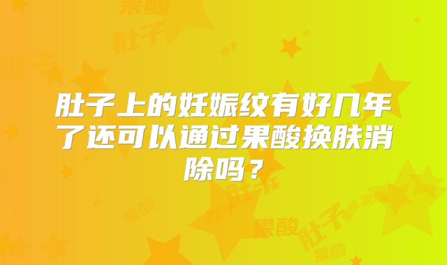 肚子上的妊娠纹有好几年了还可以通过果酸换肤消除吗？