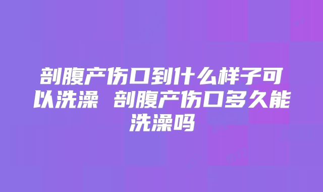 剖腹产伤口到什么样子可以洗澡 剖腹产伤口多久能洗澡吗