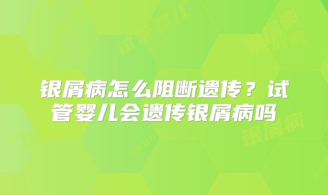 银屑病怎么阻断遗传?试管婴儿会遗传银屑病吗